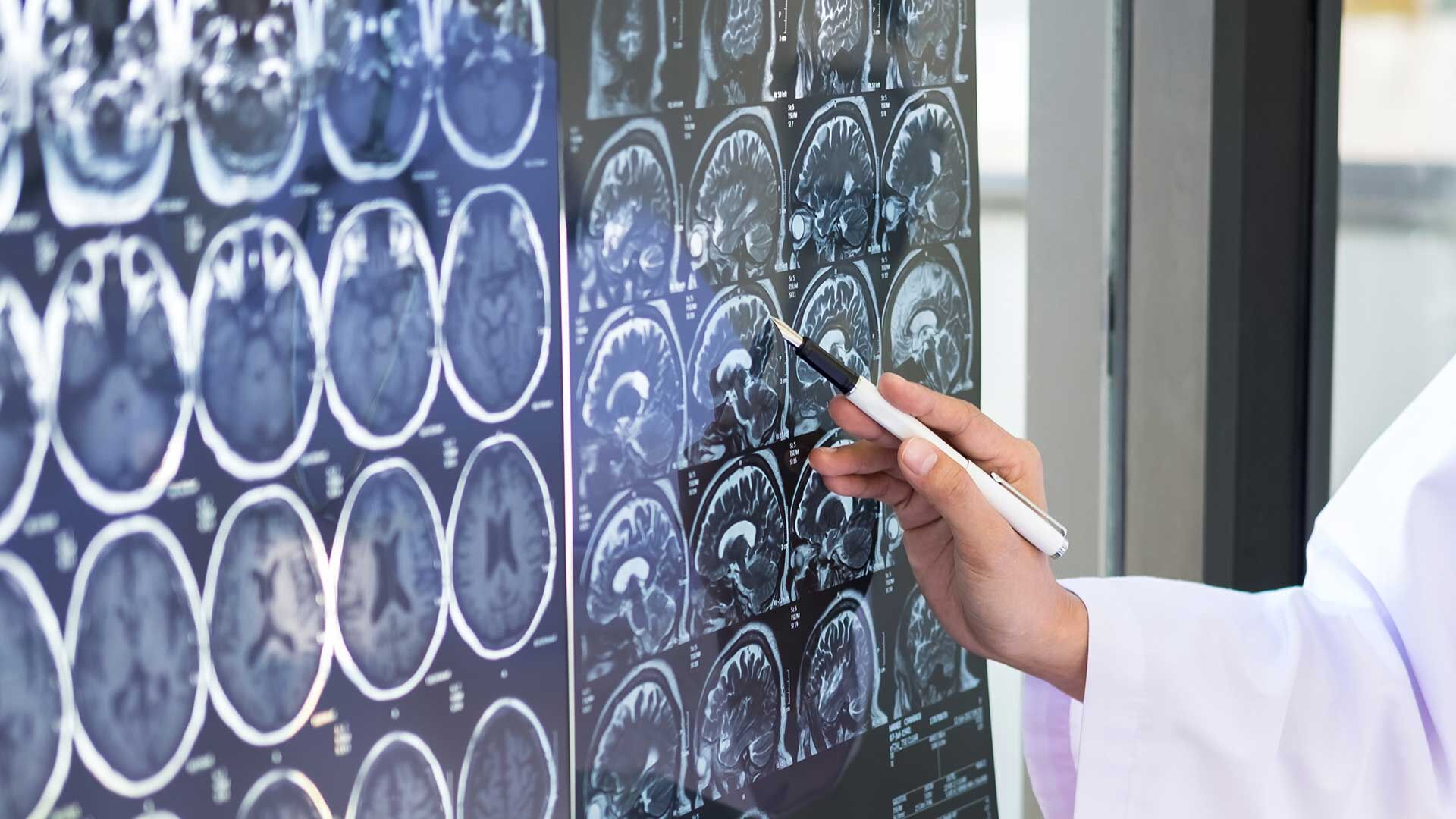 Eine Hand mit einem Stift zeigt auf die Aufnahmen einer CTM.