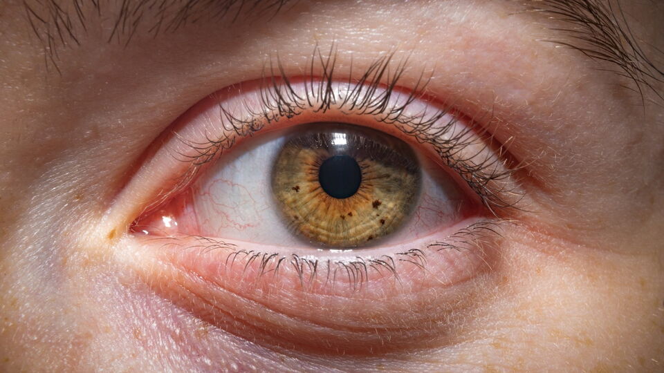 Bild zum Artikel„Schutzschild fürs Auge: Wie Lipide den Tränenfilm stärken“