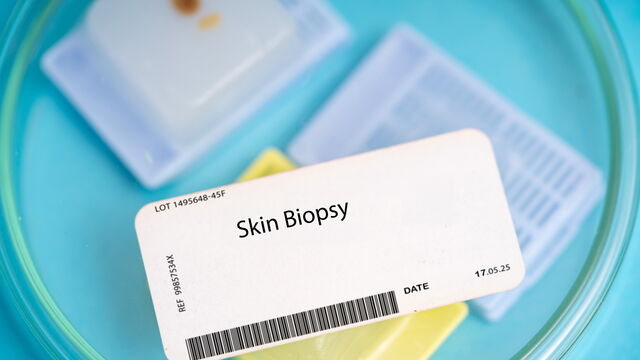 Bild zum Artikel„Revolution im Hautscreening: Wie die optische Kohärenztomographie die Dermatologie verändert“