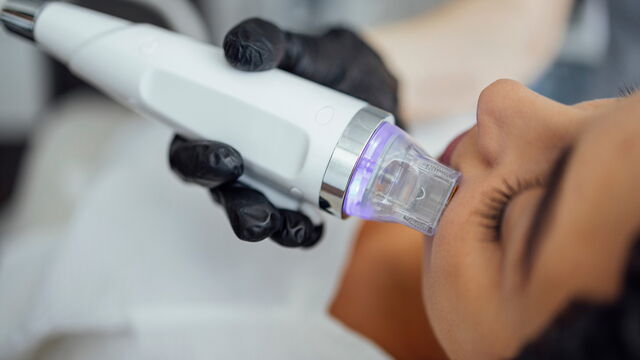 Bild zum Artikel„Radiofrequenz-Microneedling: Klinische Effekte korrelieren mit applizierter Energie“