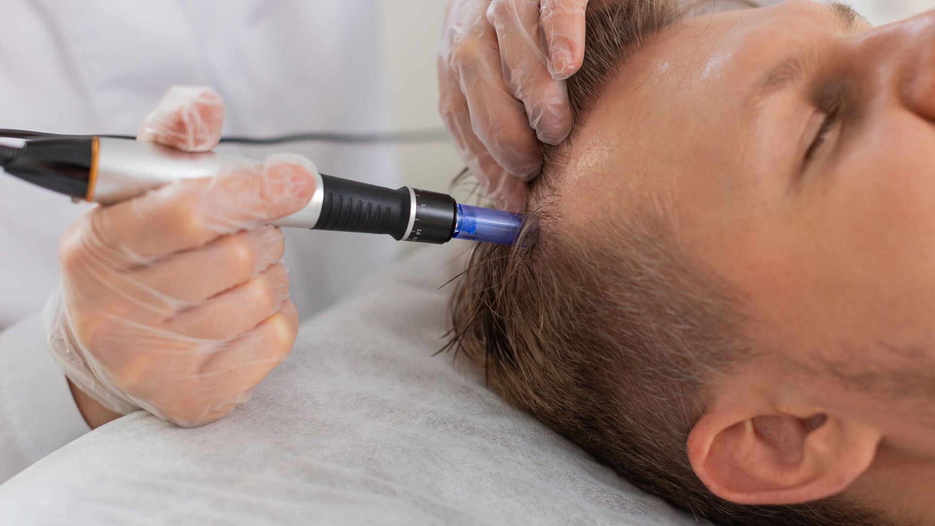 Haarwurzelbehandlung mit Laser
