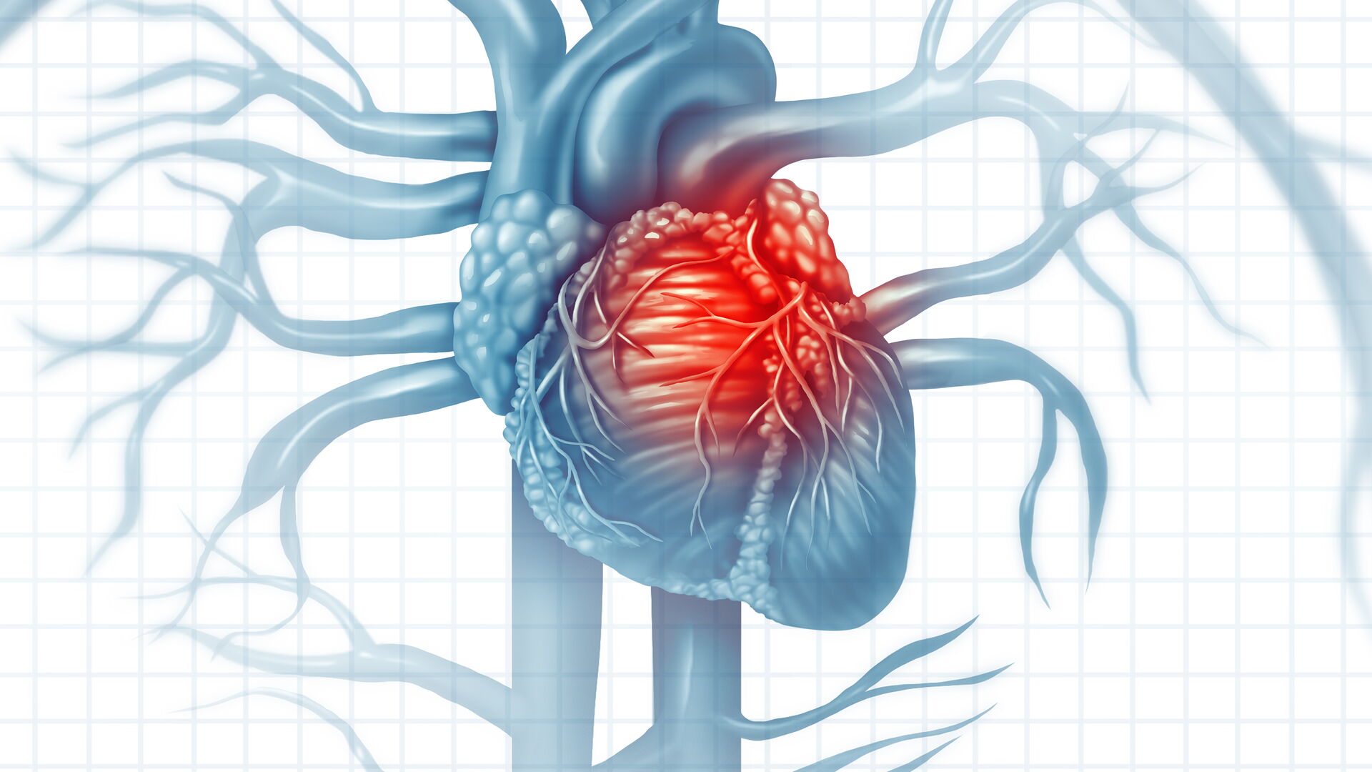 Cardiovascular Disease